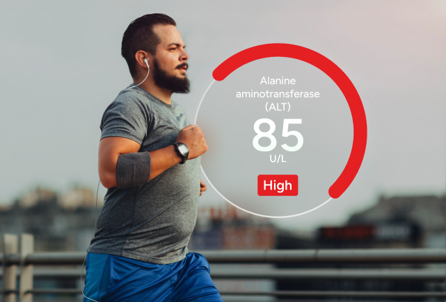 Advanced Fatty Liver Disease Test Panel number 2